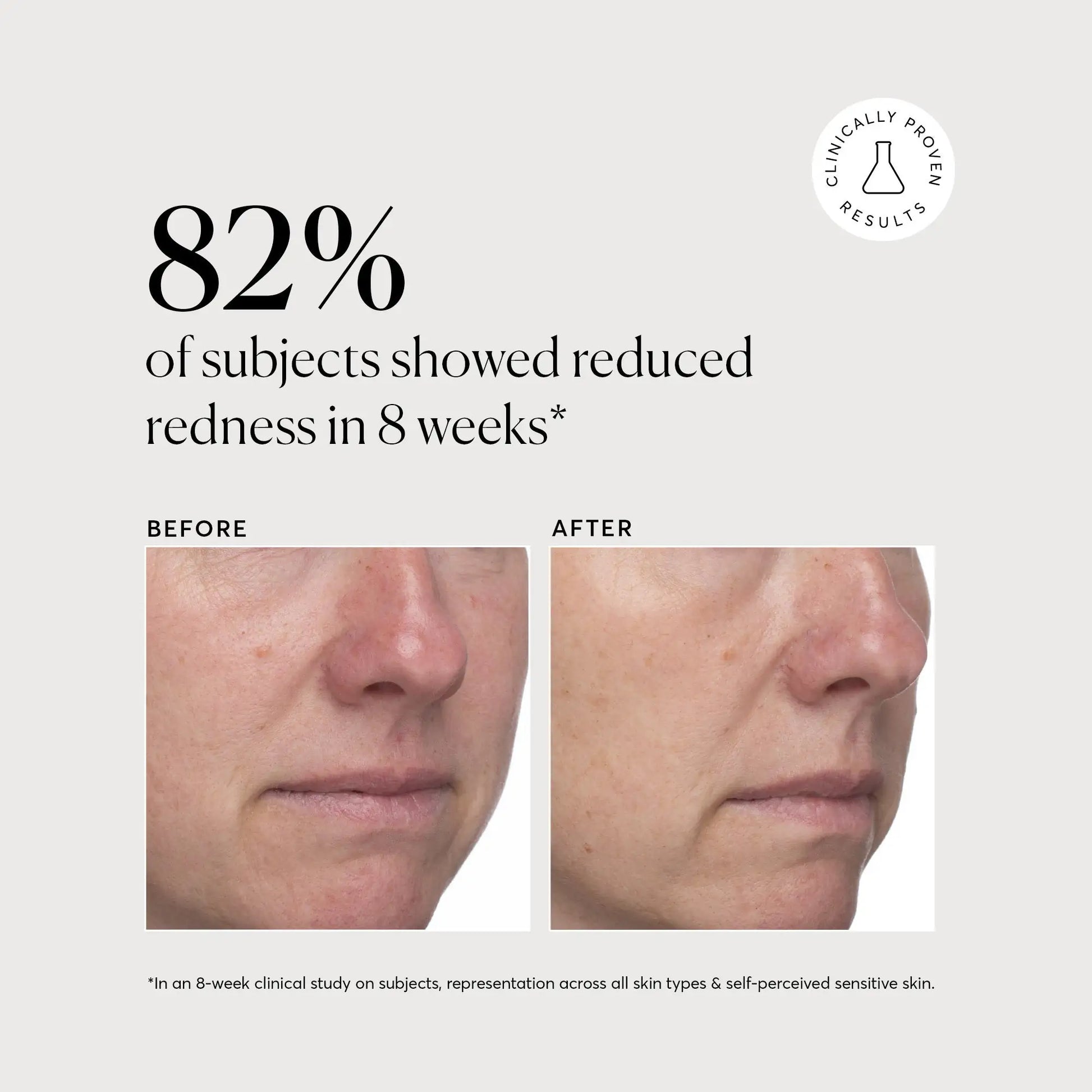 azelaic-acid-derivative-complex-10-j8 NATR-10023-Alt-Images-Azelaic-Acid-Derivative-Complex-10_-05.webp