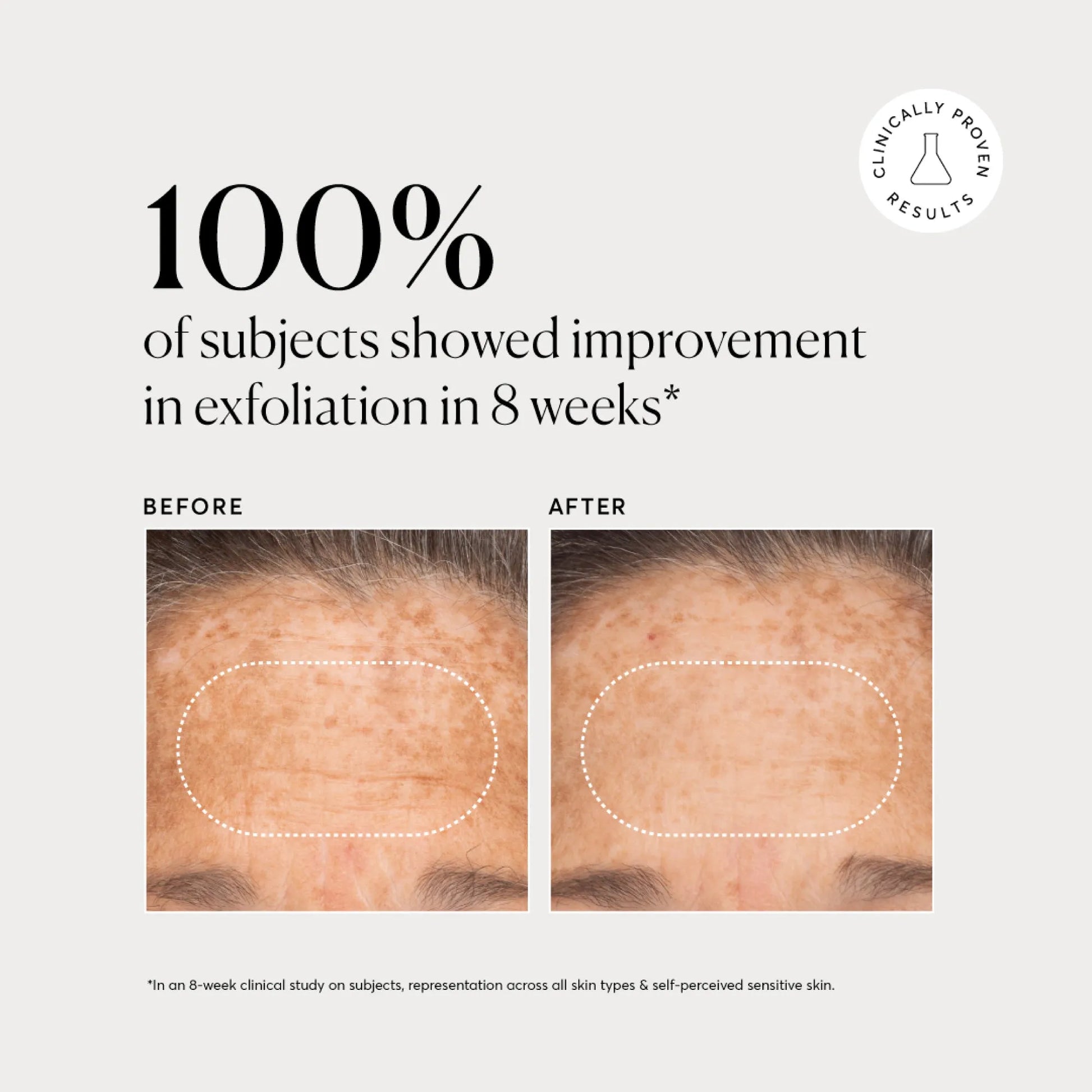 bha-liquid-exfoliant-2-b3 NATR-10027-Alt-Images-BHA-Liquid-Exfoliant-2_-03.webp